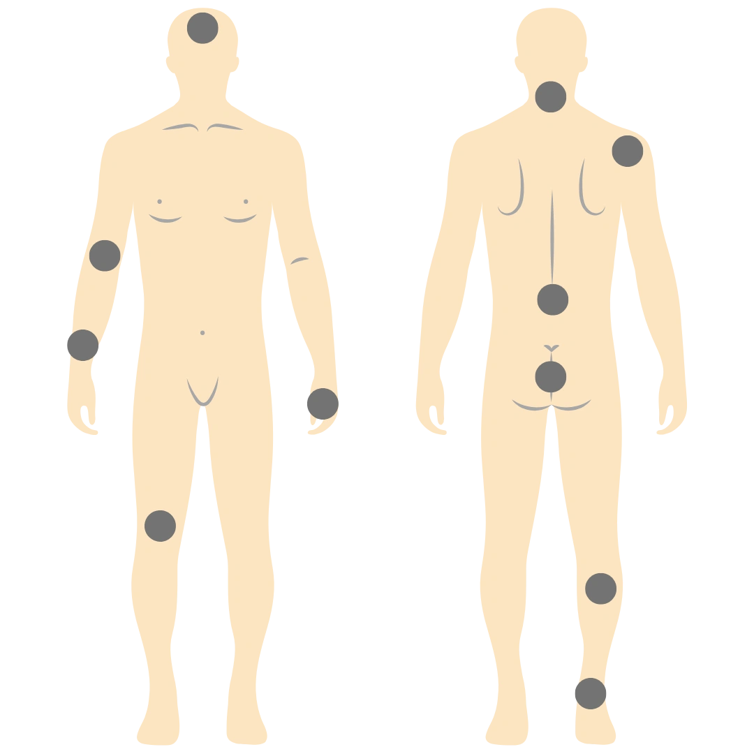 Body Anatomy - physiotherapy